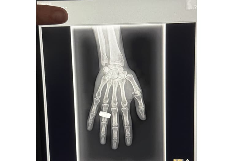 宇宙初のX線撮影が実現